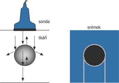 zkresleni