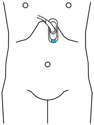 rez_sagitalni_AO