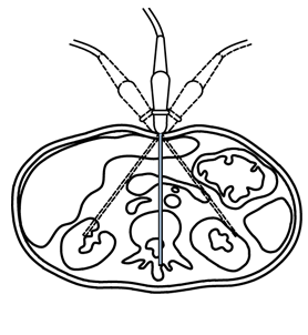 naklapeni