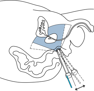 houpani