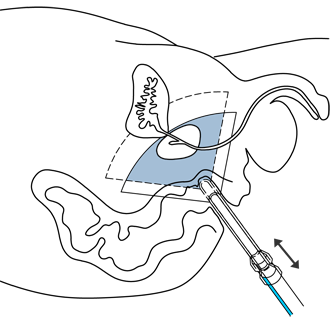 zasouvani