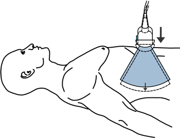 stlaceni