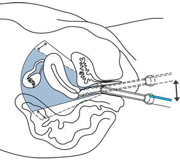 houpani